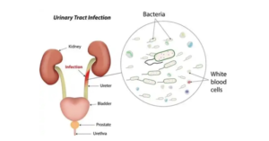 Eat These 5 Foods Regularly to Clean Your Urinary Tract and Prevent Kidney Problems