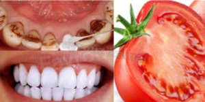 Enhance Your Smile Naturally: Tomato-Based Teeth Whitening